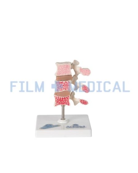 Anatomical Model of the Spine